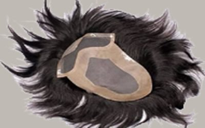 hair-patch-service